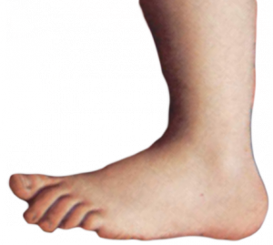 Monty Python foot